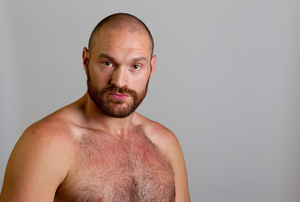 Tyson Fury